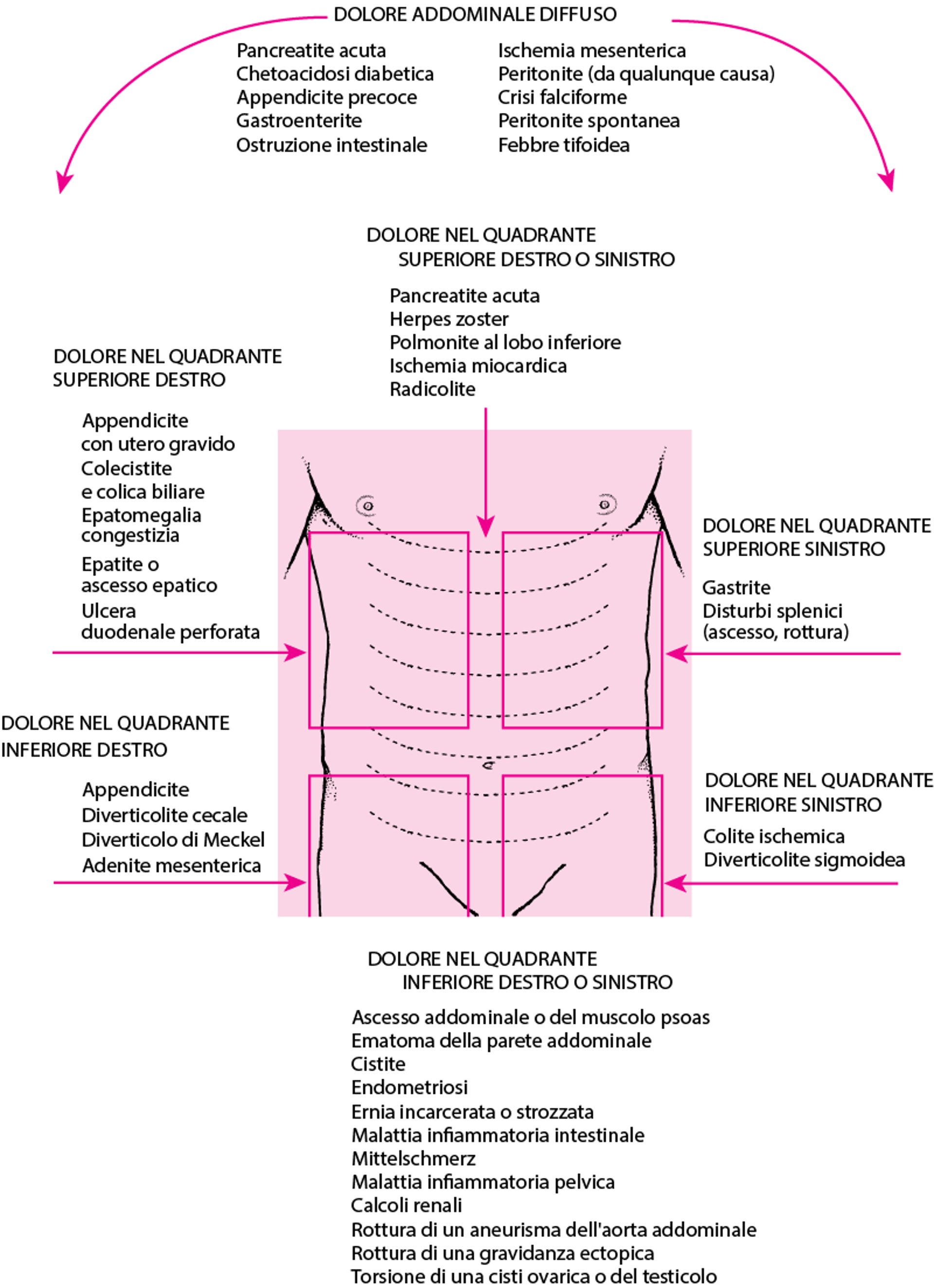 Sede del dolore addominale e possibili cause