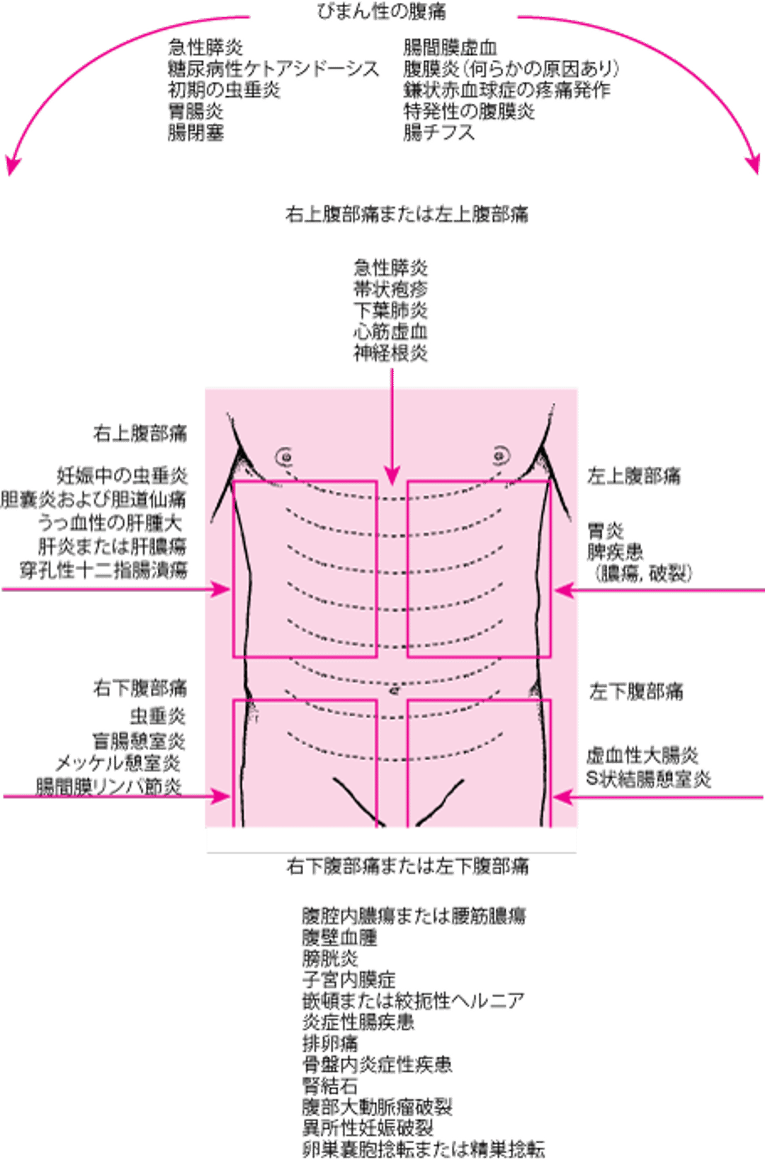 腹痛の部位と考えられる原因