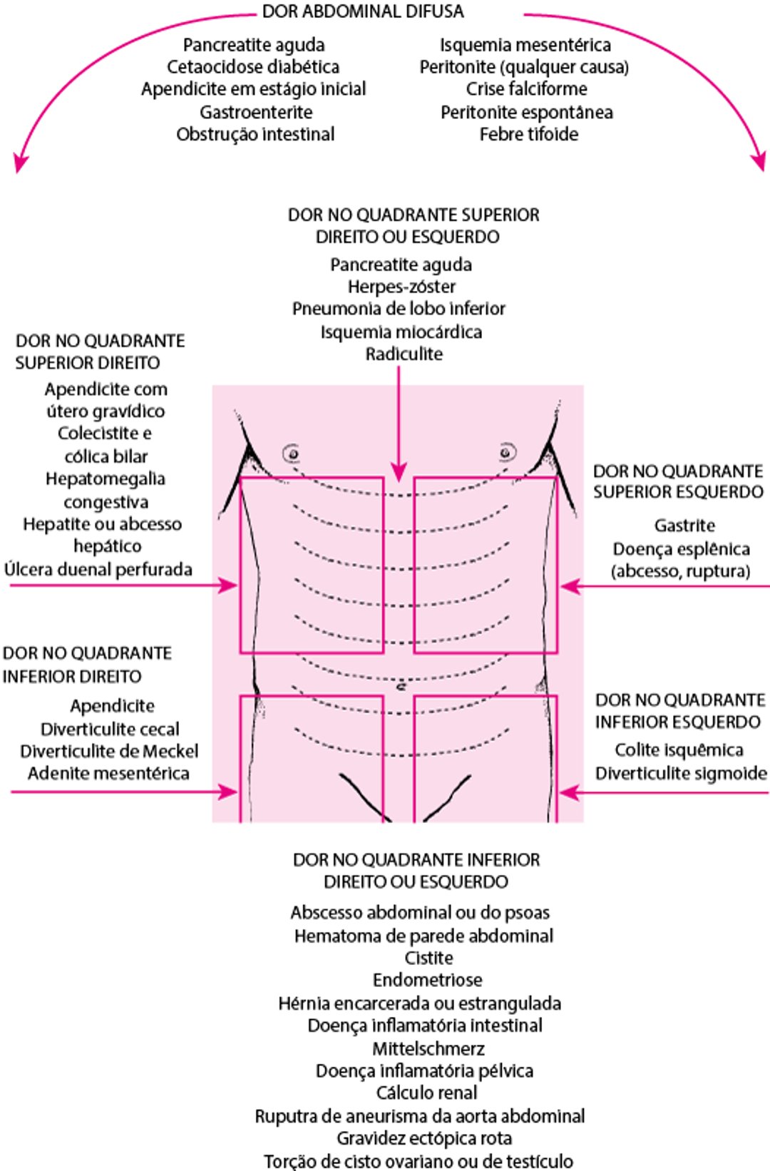 Localização da dor abdominal e possíveis causas