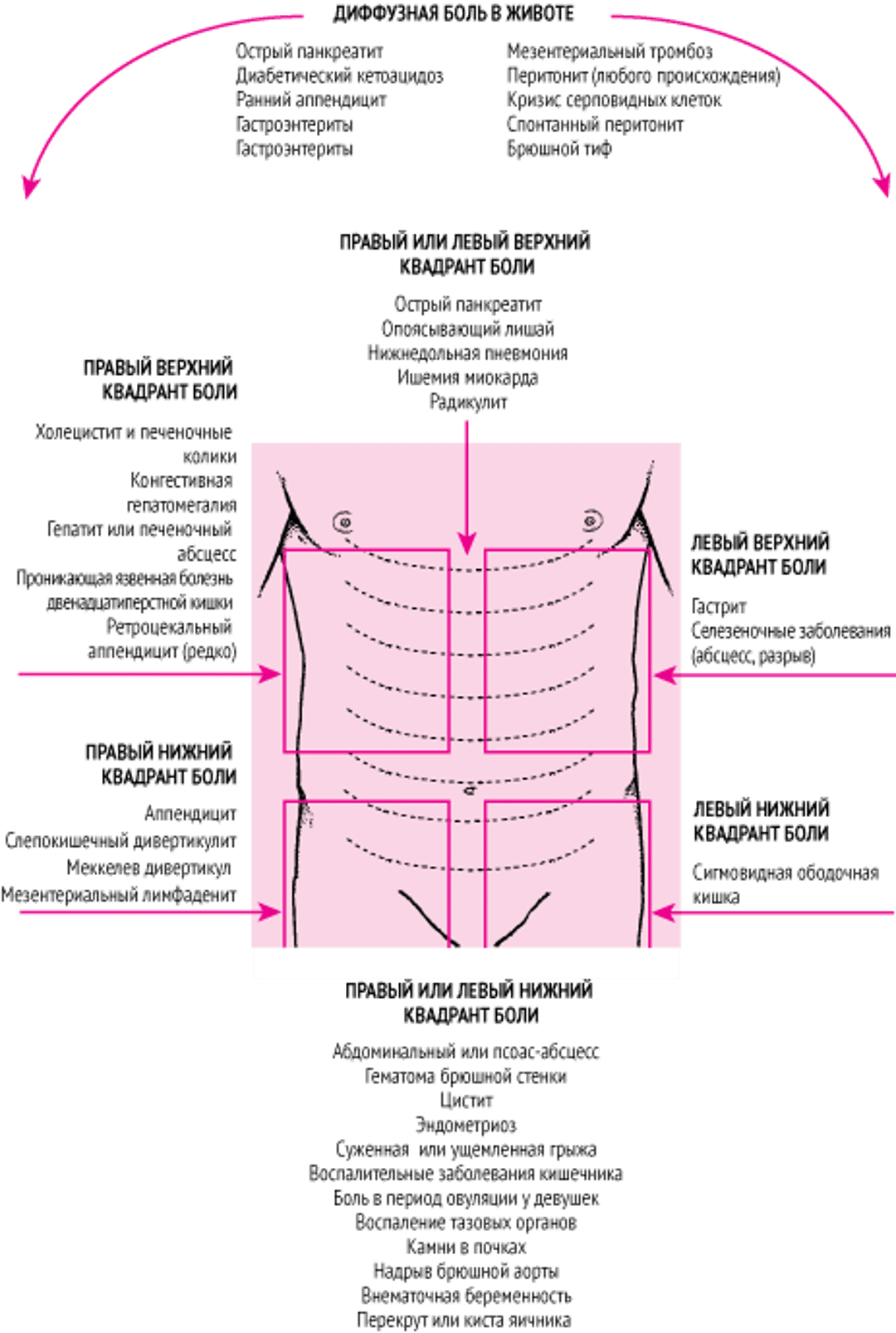 Локализация боли в животе и ее возможные причины