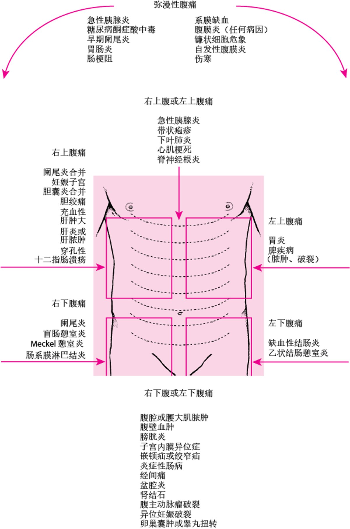 腹痛的部位及可能的病因