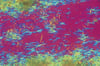 Gout Crystals