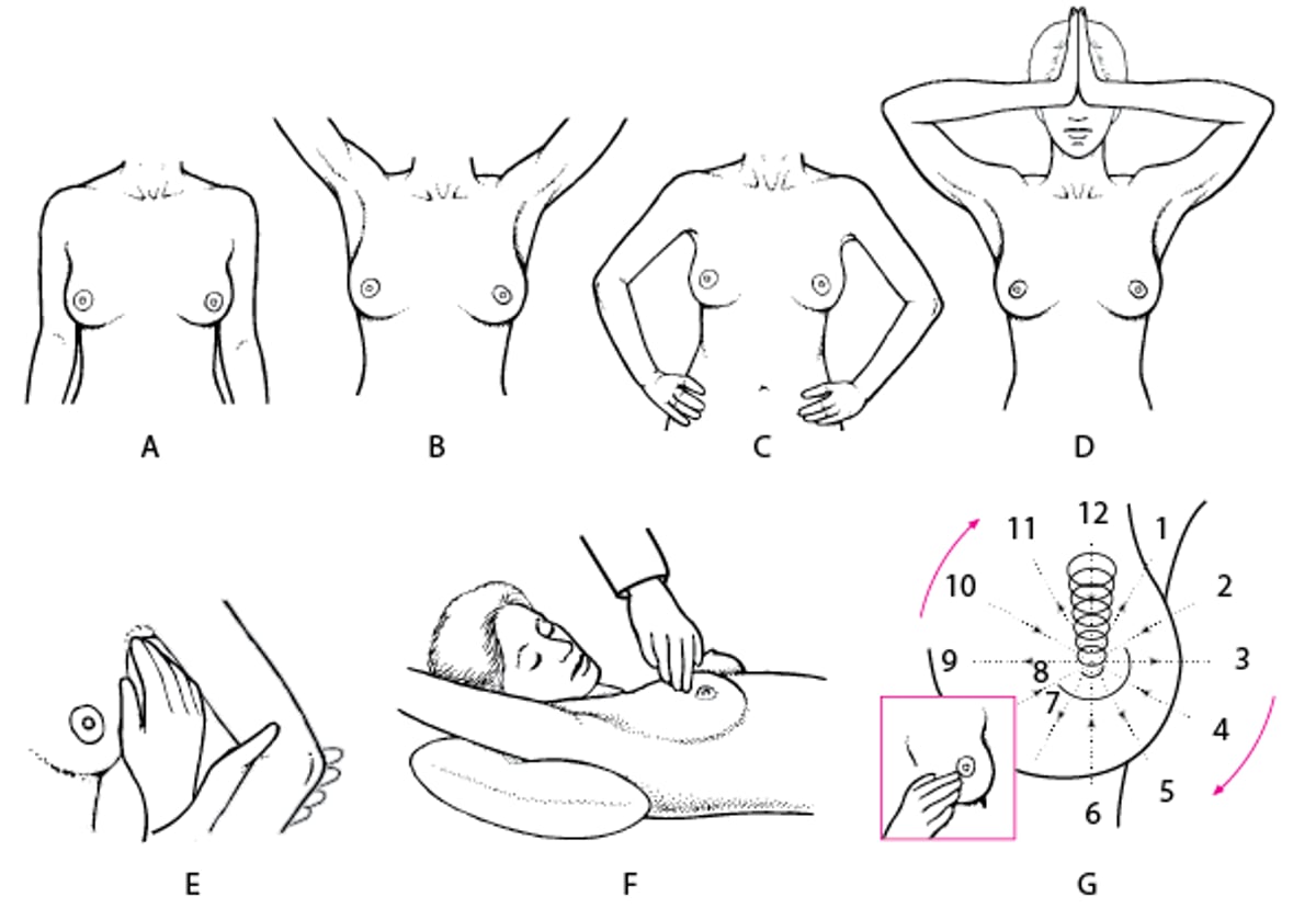 Breast Examination