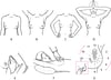 Examen des seins