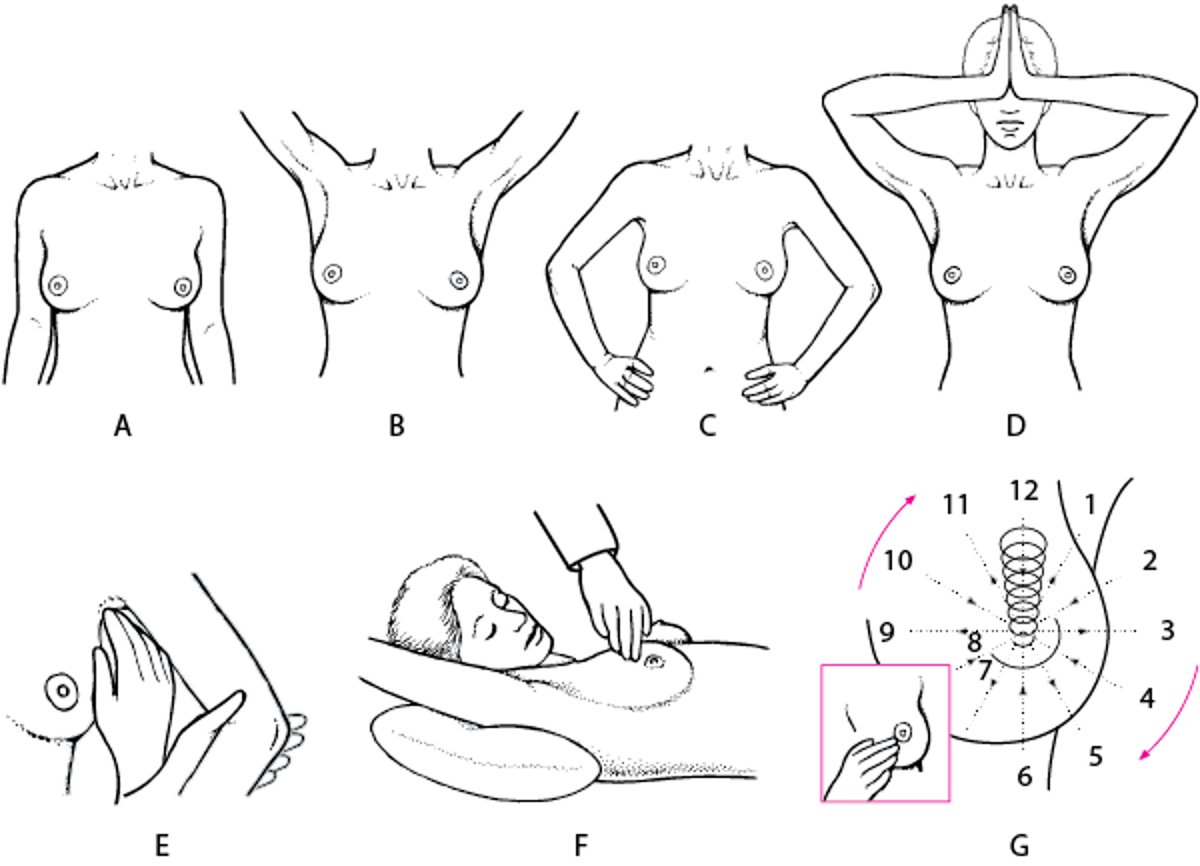 Examen des seins
