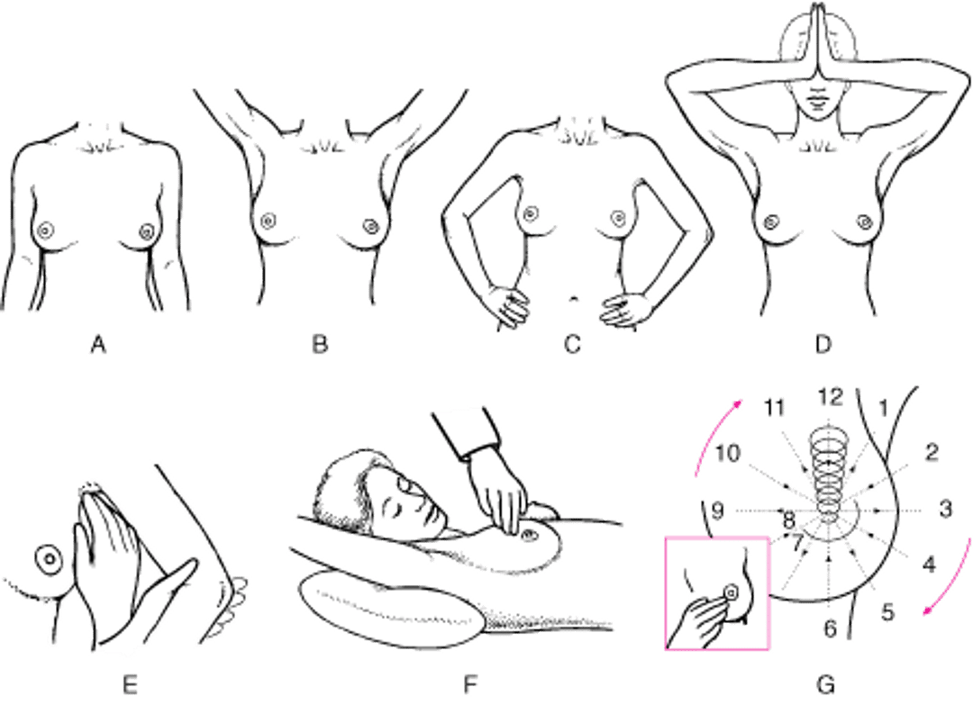 Обследование груди