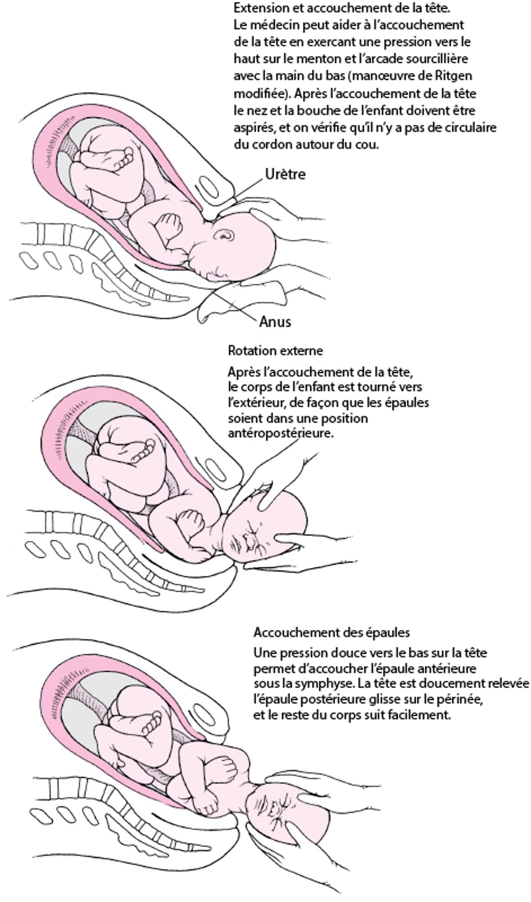 Séquence des événements de l'accouchement des présentations du vertex