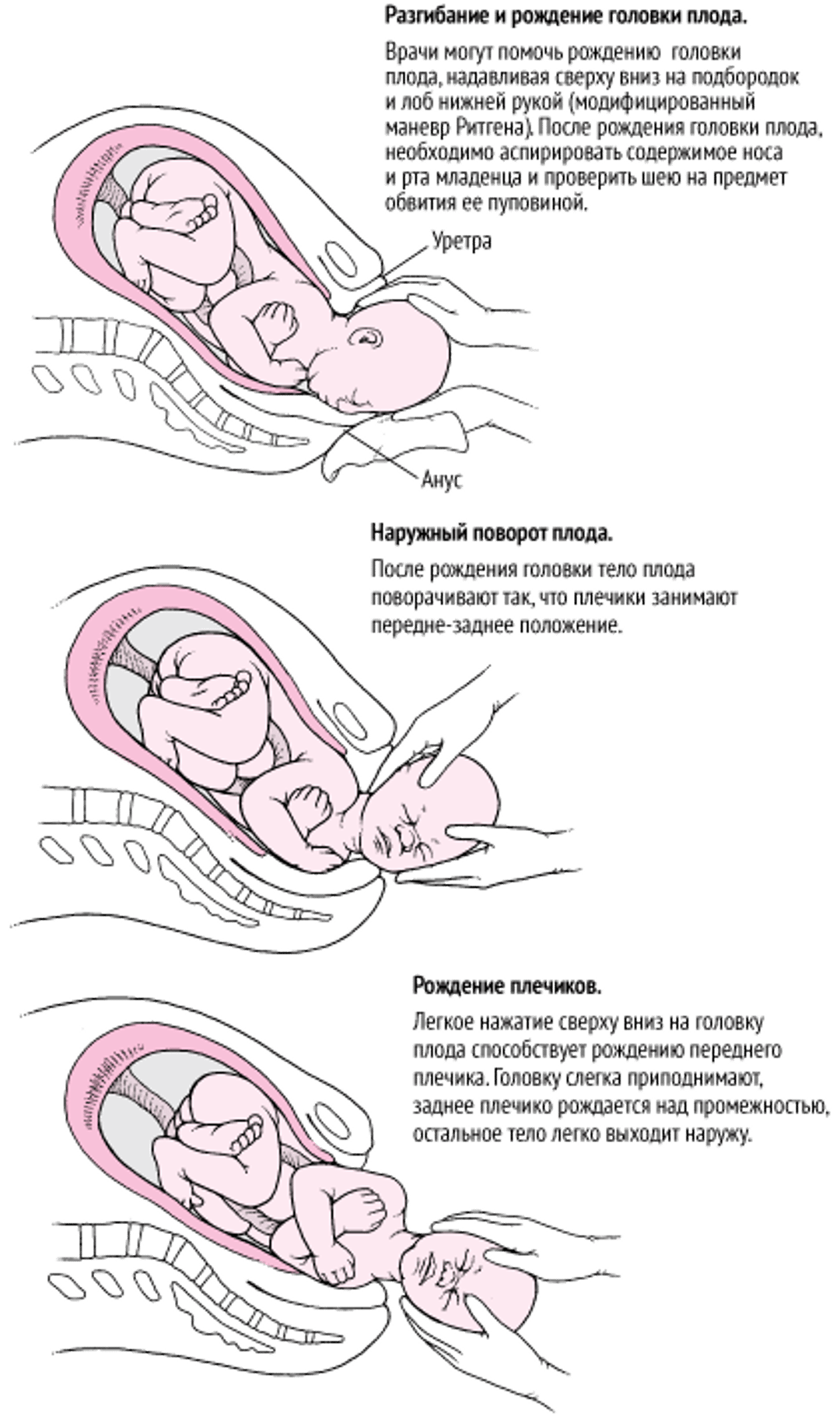 Последовательность событий при родах в затылочном предлежании