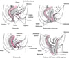 Prolasso degli organi pelvici