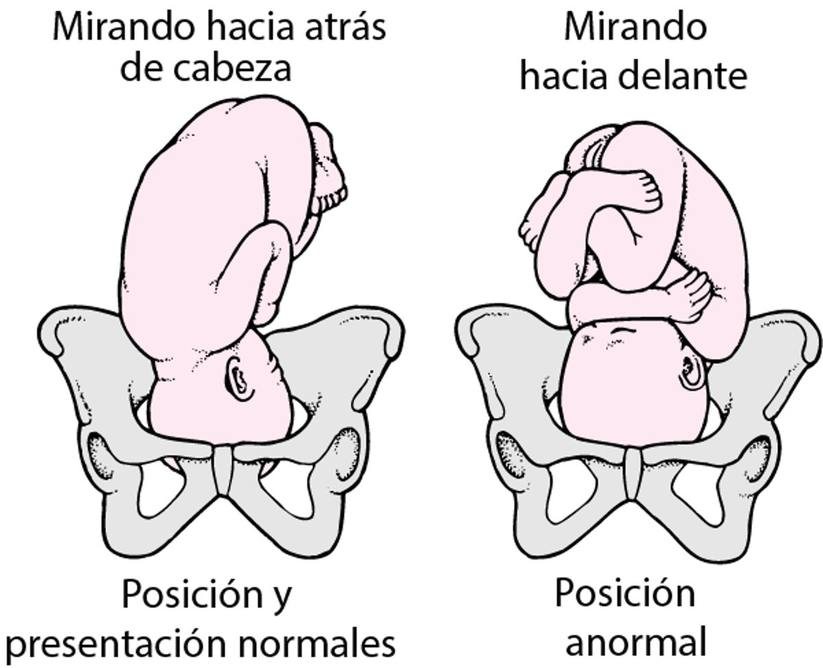 Posición y presentación del feto