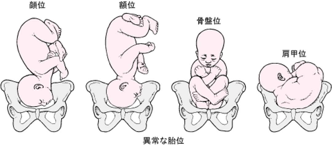 胎児の胎向と胎位