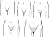 Representação esquemática dos estágios de maturidade sexual (Tanner) I a V para o desenvolvimento de pelos pubianos em meninas