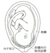 前置血管
