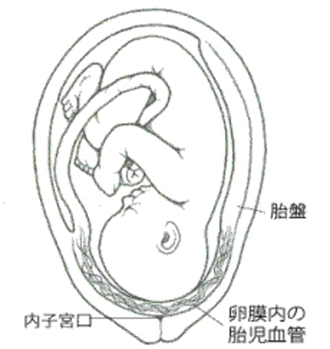 前置血管