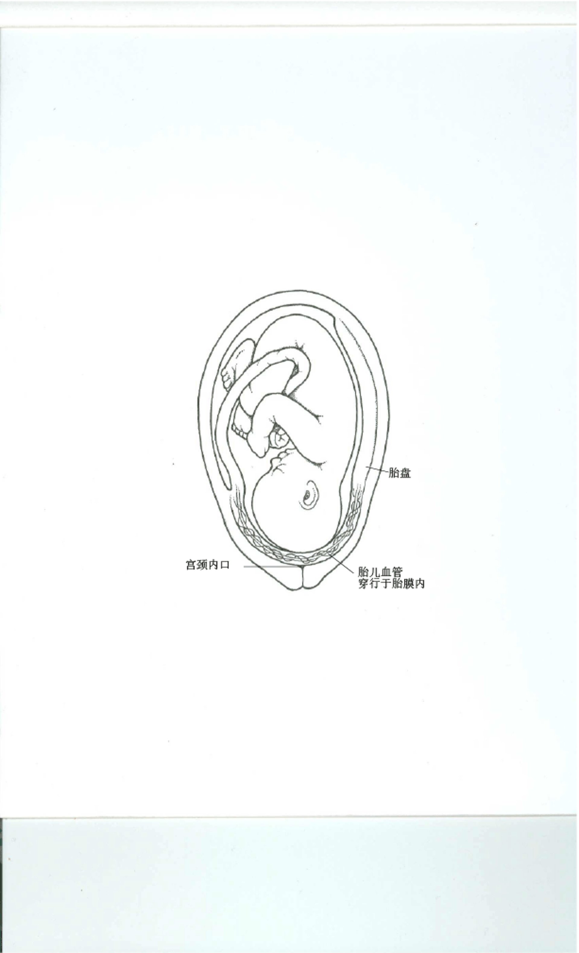 前置血管
