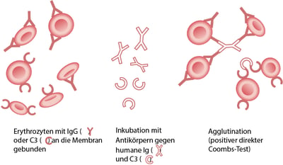 Direkter Antiglobulin-(Direkter Coombs)-Test