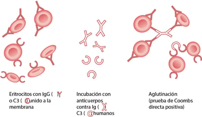 Prueba de la antiglobulina directa (de Coombs directa)