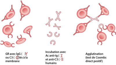 Test direct à l'antiglobuline (de Coombs direct)