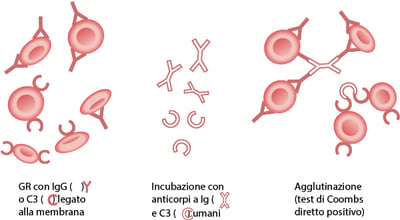 Test delle antiglobuline diretto (di Coombs diretto)