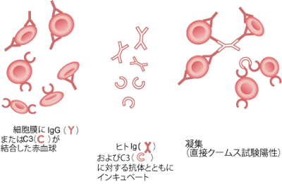 直接抗グロブリン試験（直接クームス試験）