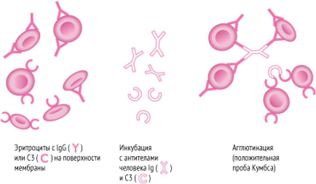 Прямой антиглобулиновый тест (прямая проба Кумбса).