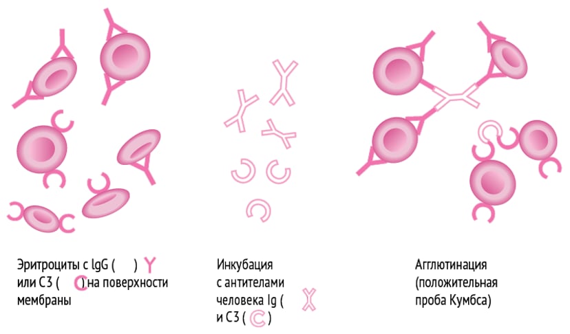 Overview Of Hemolytic Anemia overview-of-hemolytic-anemia