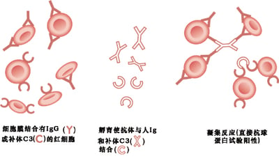 直接抗人球蛋白（直接Coombs）试验