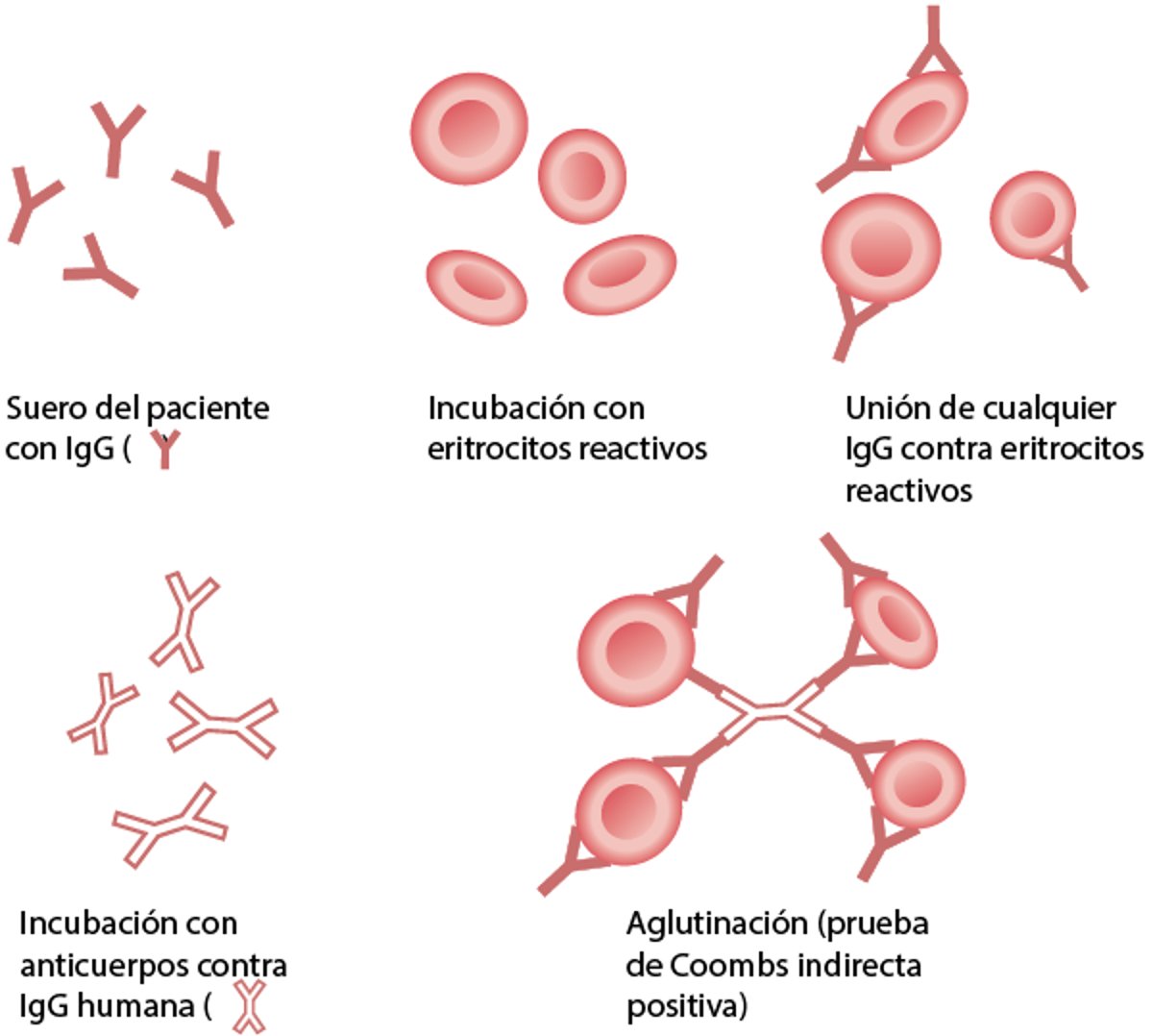 Prueba de la antiglobulina indirecta (de Coombs indirecta)