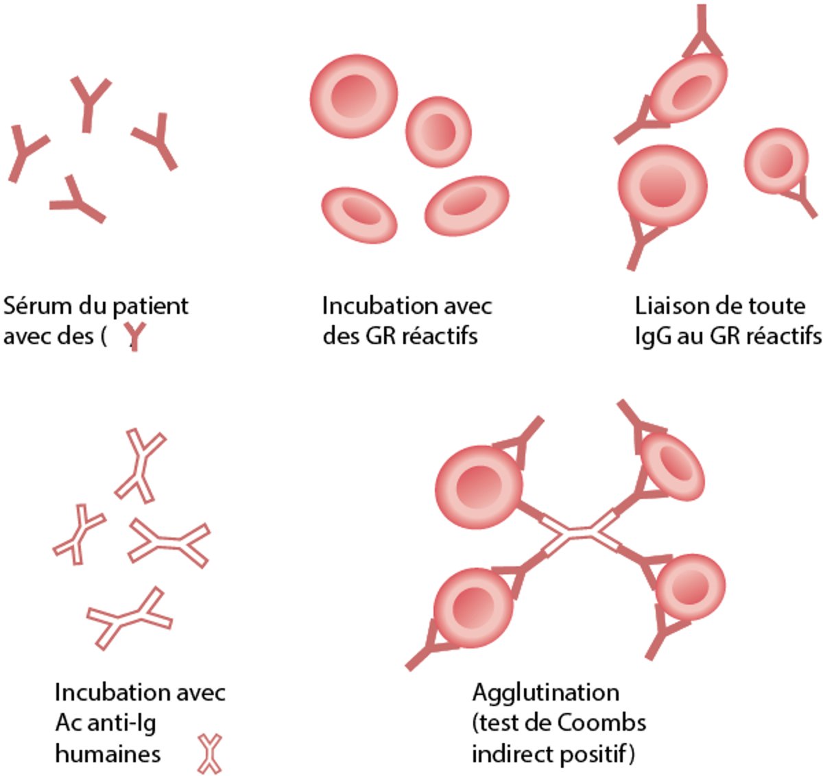 Test indirect à l'antiglobuline (de Coombs indirect)