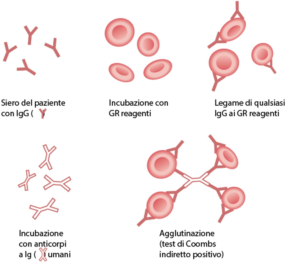 Test dell'antiglobulina indiretto (di Coombs indiretto)