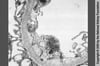 Néphropathie associée au VIH (inclusions réticulaires)