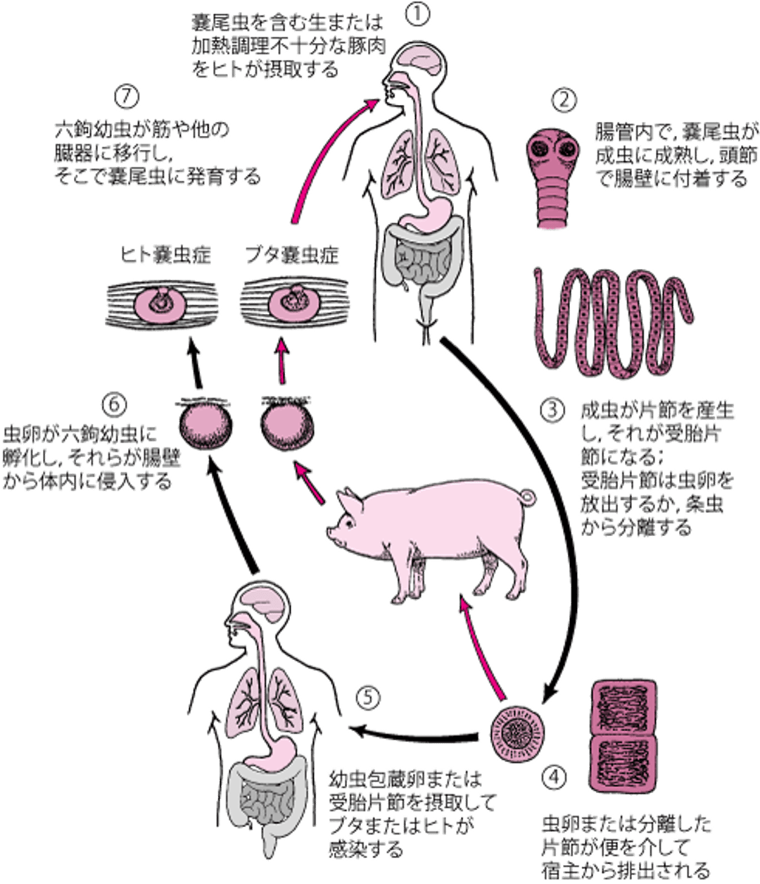 有鉤条虫（Taenia solium）の生活環