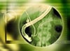 Endoscopic Retrograde Cholangiopancreatography (ERCP)