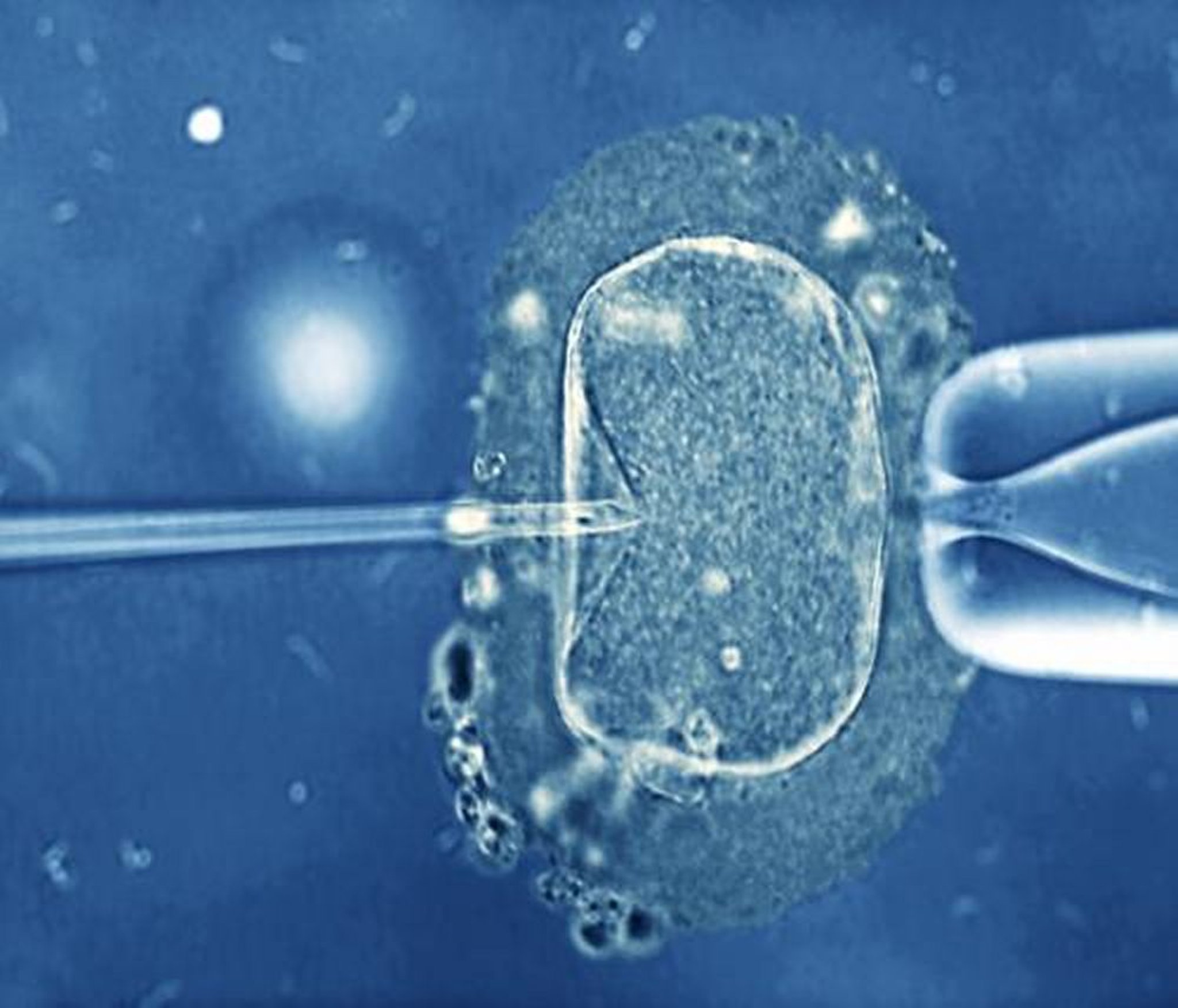 Intrazytoplasmatische Spermieninjektion (ICSI)