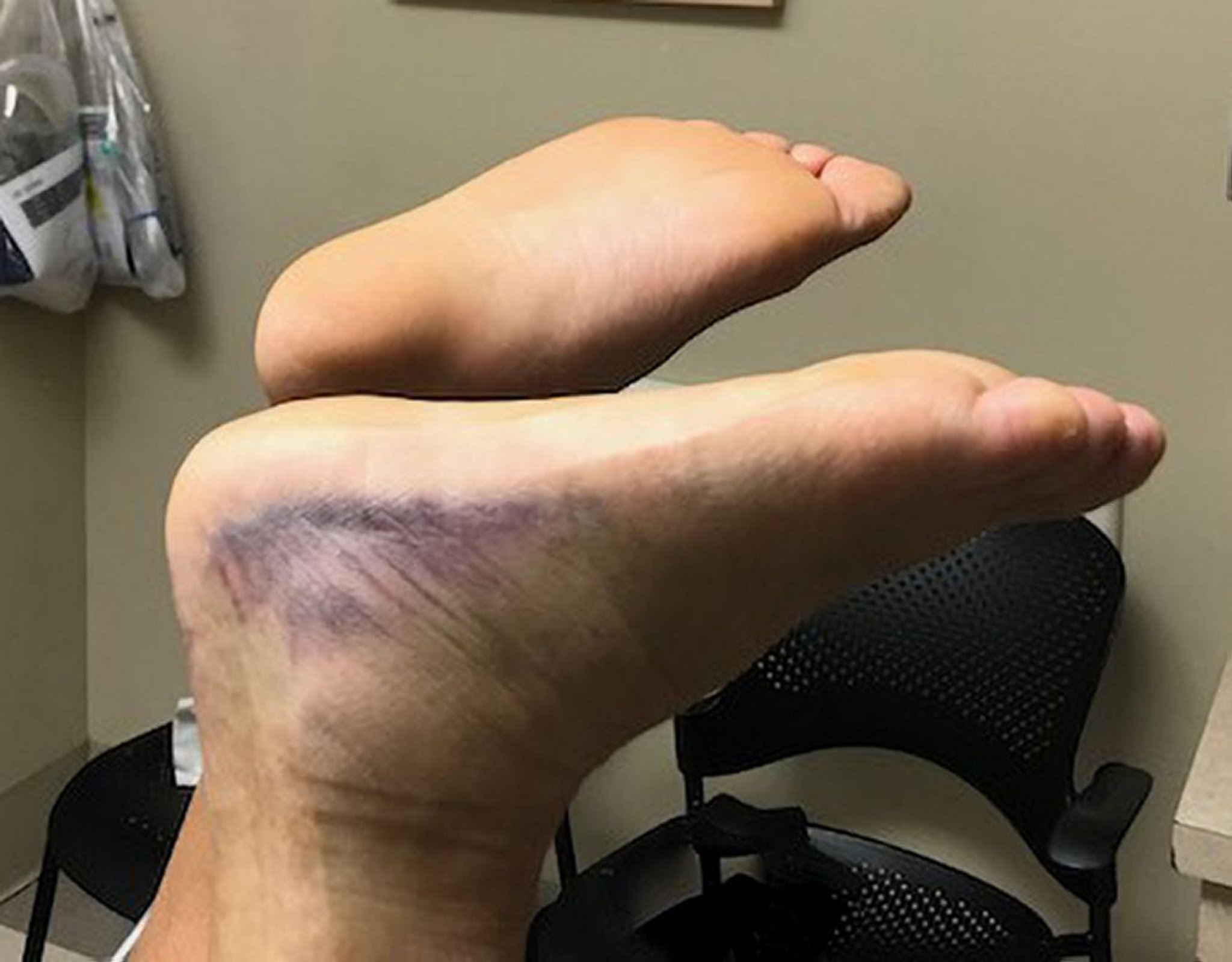 Тест Матлеса