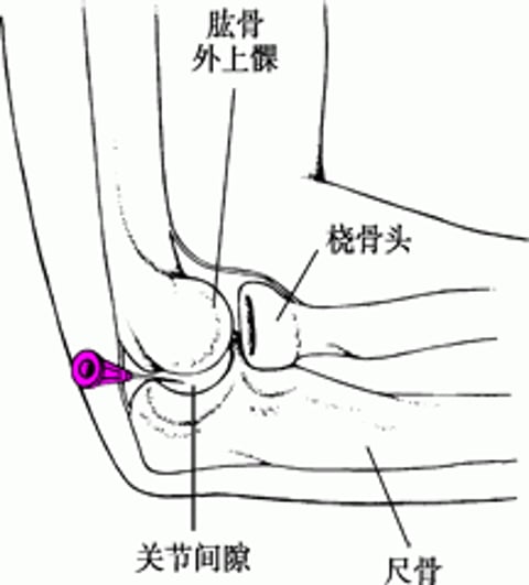 肘关节穿刺术