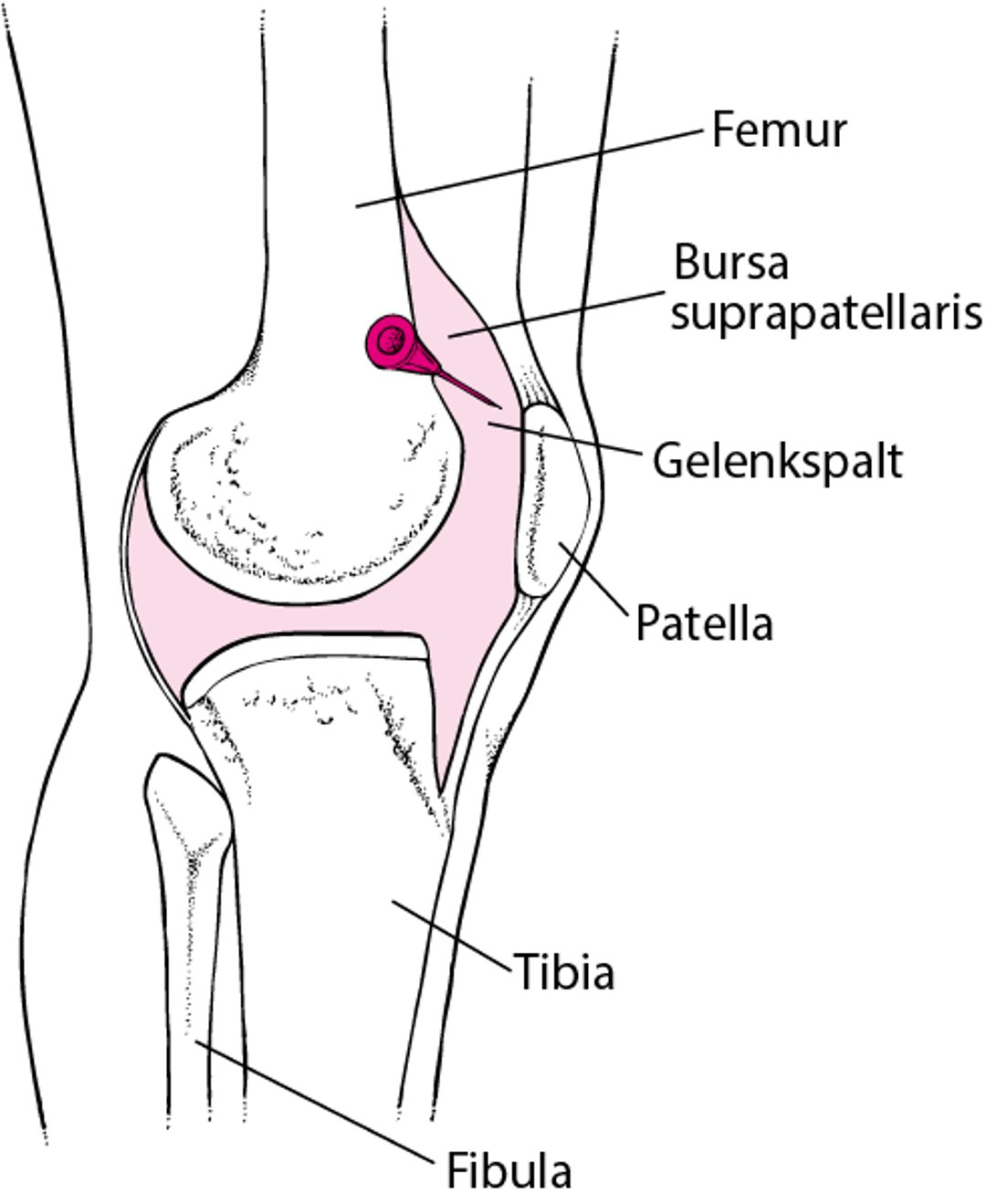 Arthrozentese des Knies