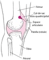 Arthrocentèse du genou