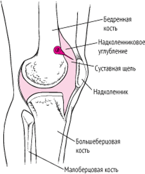 Обычно пунктируется верхний заворот коленного сустава
