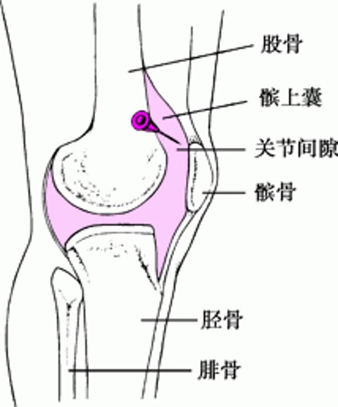 膝关节穿刺术