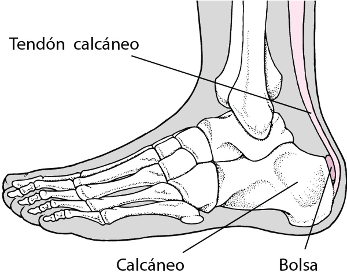 Bursitis en el talón