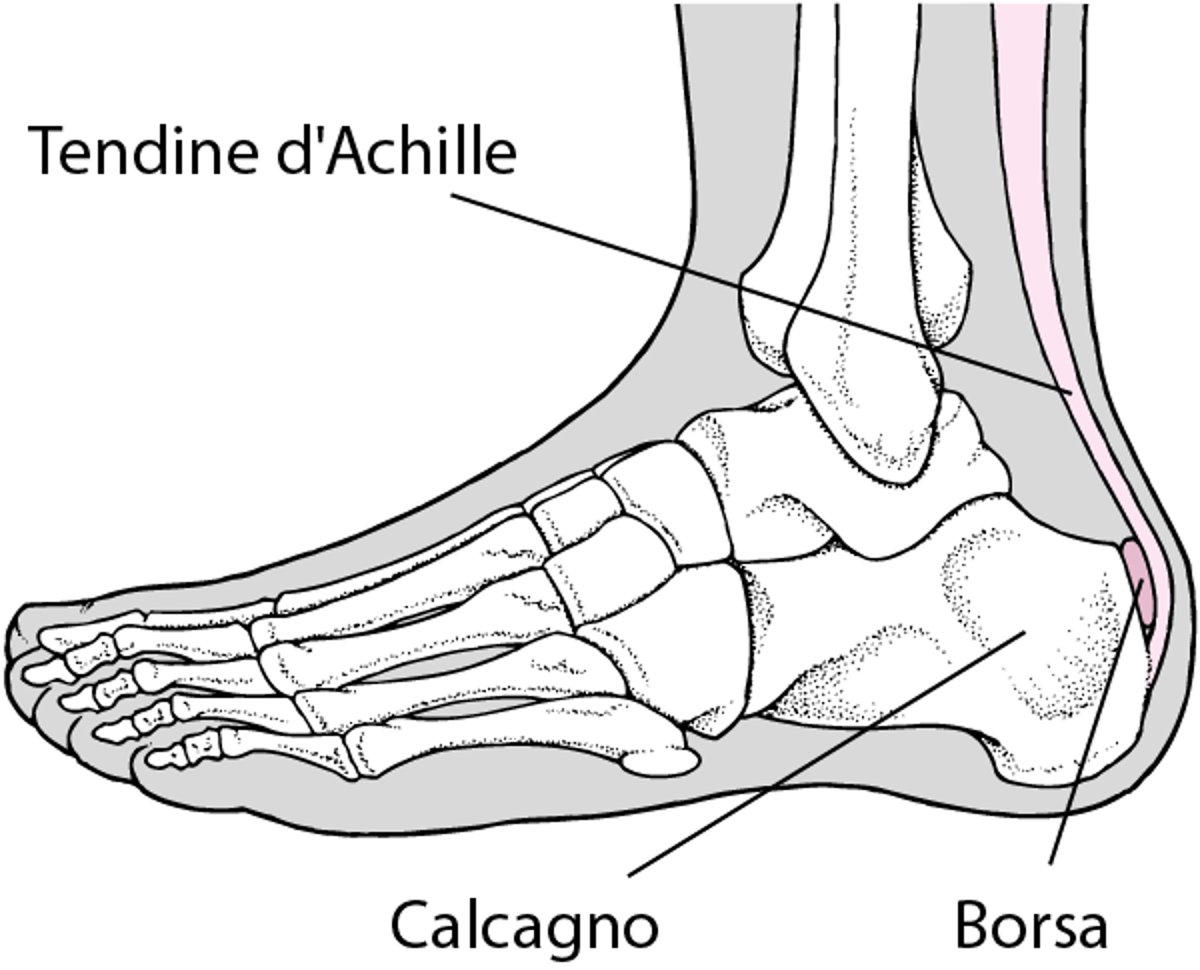 Borsite calcaneare
