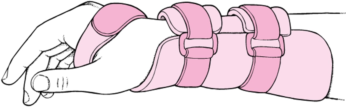 Tala do punho neutra