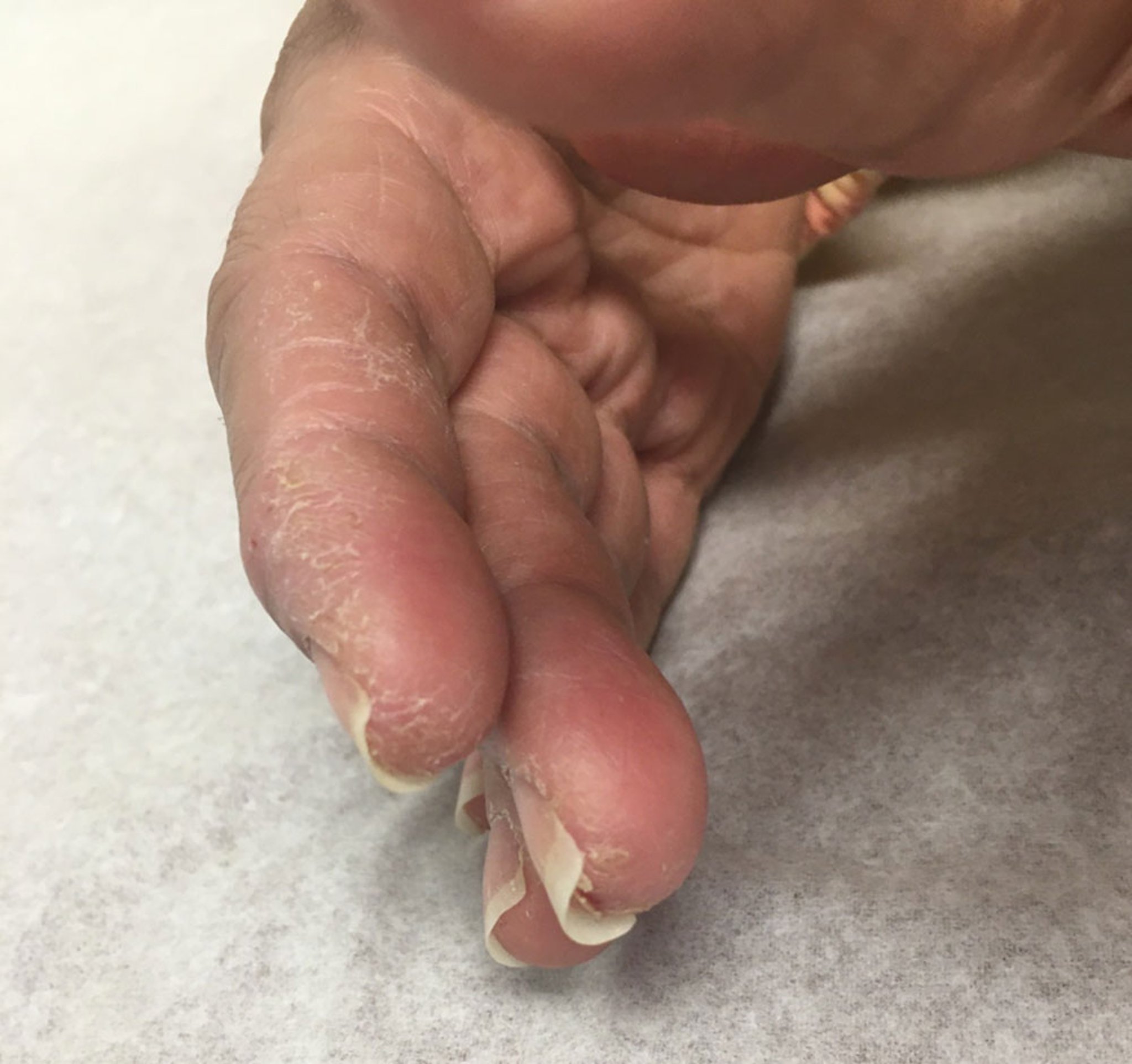 Mechanic's Hands (2)