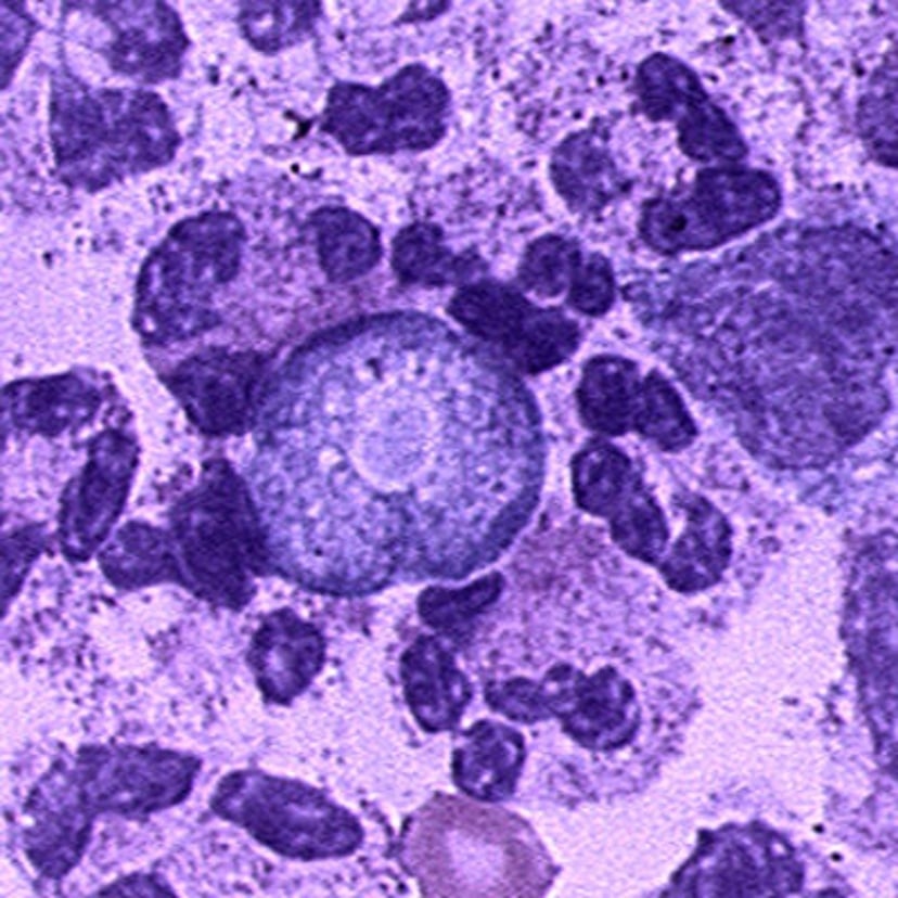 Trofozoíto de <i >Naegleria fowleri</i>