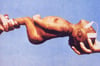 Tetano neonatale