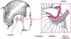 Descompresión microvascular