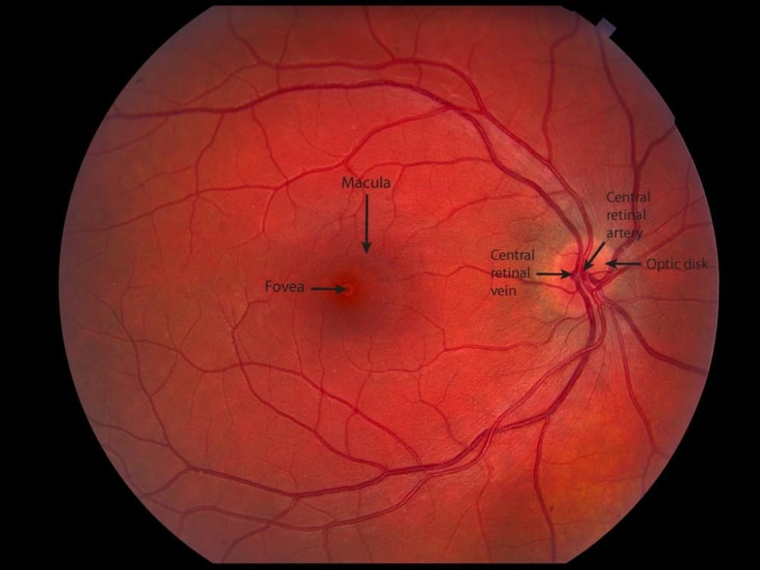 Image:Normal Retina-Merck Manual Professional Edition