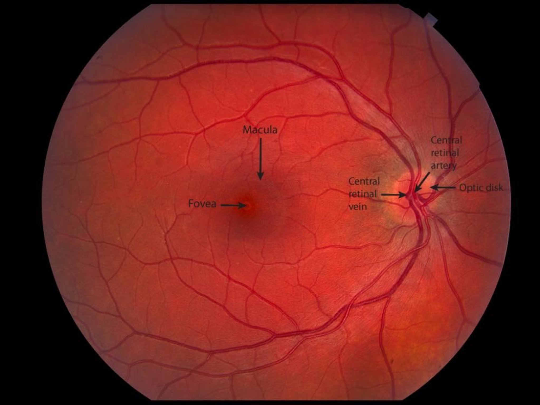 Normale Retina