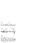 EEG durante el sueño sin movimientos oculares rápidos (NREM)